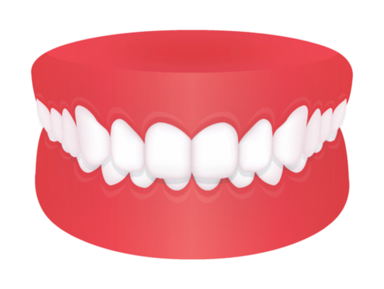 Protuding Upper Teeth